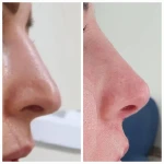 تصویر متخصص پوست مو زیبایی لیزر دکتر فرزانه علمشاهی