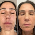  کلینیک پوست، مو و زیبایی نیلا