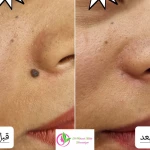 دکتر بهاره ملکی متخصص پوست ، مو و زیبایی