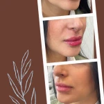 كلينيک پوست ، مو وزیبایی رزهای طلايی