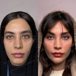 مرکز لیزر و زیبایی هانیسا