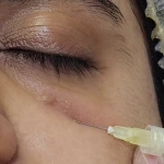 مطب زیبایی دکتر مینو شعبانی