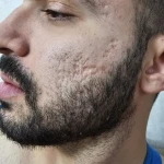 کلینیک پوست مو زیبایی و لیزر سلام پوست