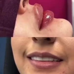 کلینیک  پوست مو زیبایی و لیزر ویان
