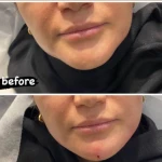 کلینیک زیبایی پارسیان آلفا
