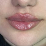  کلینیک زیبایی و لیزر دکتر حکیم پور