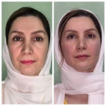 نمونه کار کلینیک زیبایی کیوت
