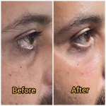 نمونه کار کلینیک زیبایی و لیزر مو گندم