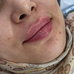 کلینیک لیزر پوست و مو زیبایی توکا