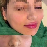 نمونه کار کلینیک پوست مو زیبایی و لیزر ونوشه