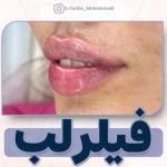 مرکز پوست ،مو و زیبایی دکتر فریبا محمدی