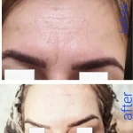 نمونه کار کلینیک زیبایی و لیزر الماس