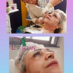 مرکز لیفت پوست و درمان ریزش مو مرجان