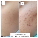 متخصص پوست مو زیبایی لیزر دکتر فرزانه علمشاهی