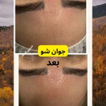 آکادمی تخصصی پوست و مو شیرین افشار