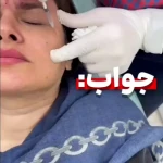 کلینیک زیبایی و لیزر کامالیزر