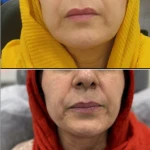 نمونه کار مرکز لیزرو کلینیک زیبایی طراوت