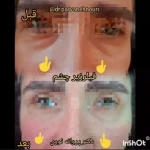 کلینیک زیبایی مرکز لیزر دکترپروانه نوری