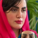 کلینیک زیبایی پل