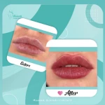 کلینیک تخصصی پوست مو زیبایی و لیزر هانا