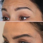 نمونه کار کلینیک پوست مو زیبایی و لیزر آیسل
