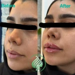 کلینیک پوست مو زیبایی و لاغری باران