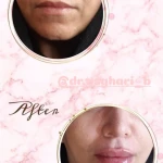 نمونه کار کلینیک زیبایی دکتر اصغری