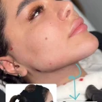 نمونه کار کلینیک تخصصی پوست و زیبایی ملینا