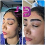 نمونه کار کلینیک پارسیان بیوتی