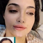 کلینیک لیزر و جراحی مینوسا