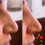 كلينيک پوست، مو و زیبایی ليليان