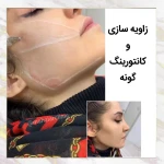 نمونه کار کلینیک زیبایی مهزیار