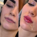 کلینیک پوست مو زیبایی و لیزر کیمیا