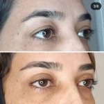 جراحی  زیبایی بینی  و صورت نئوفیس