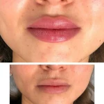 تصویر کلنیک پوست مو زیبای لیزر هیوا