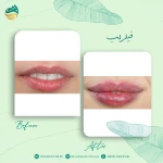 کلینیک پوست,مو و لاغری دادمان