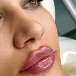 تصویر کلینیک زیبایی لیلاک