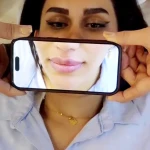نمونه کار کلینیک لیزر و جراحی مینوسا