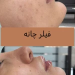 کلینیک پوست مو لیزر لاغری زیباریس