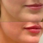 مرکز لیزر،پوست،مو و زیبایی سرو مهر