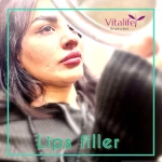 کلینیک لیزر ،ژل ،بوتاکس و لاغری ویتالایف