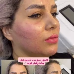 کلینیک زیبایی فریحا(پوست و مو)