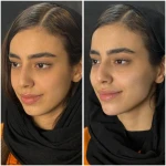 مطب زیبایی لیانارخ