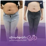 کلینیک تغذیه  رژیم درمانی دکتر مهشید دژن
