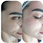 مرکز پوست سمیه مومنی