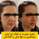 نمونه کار کلینک زیبایی دکتر مریم پوررهنما