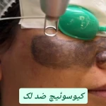 کیلینک پوست مو و لیزر نورا