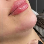 نمونه کار کلینیک زیبایی پل