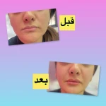 کلینیک زیبایی دکتر پوروزیری