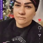 کلینیک زیبایی و پوست و مو ماه میس